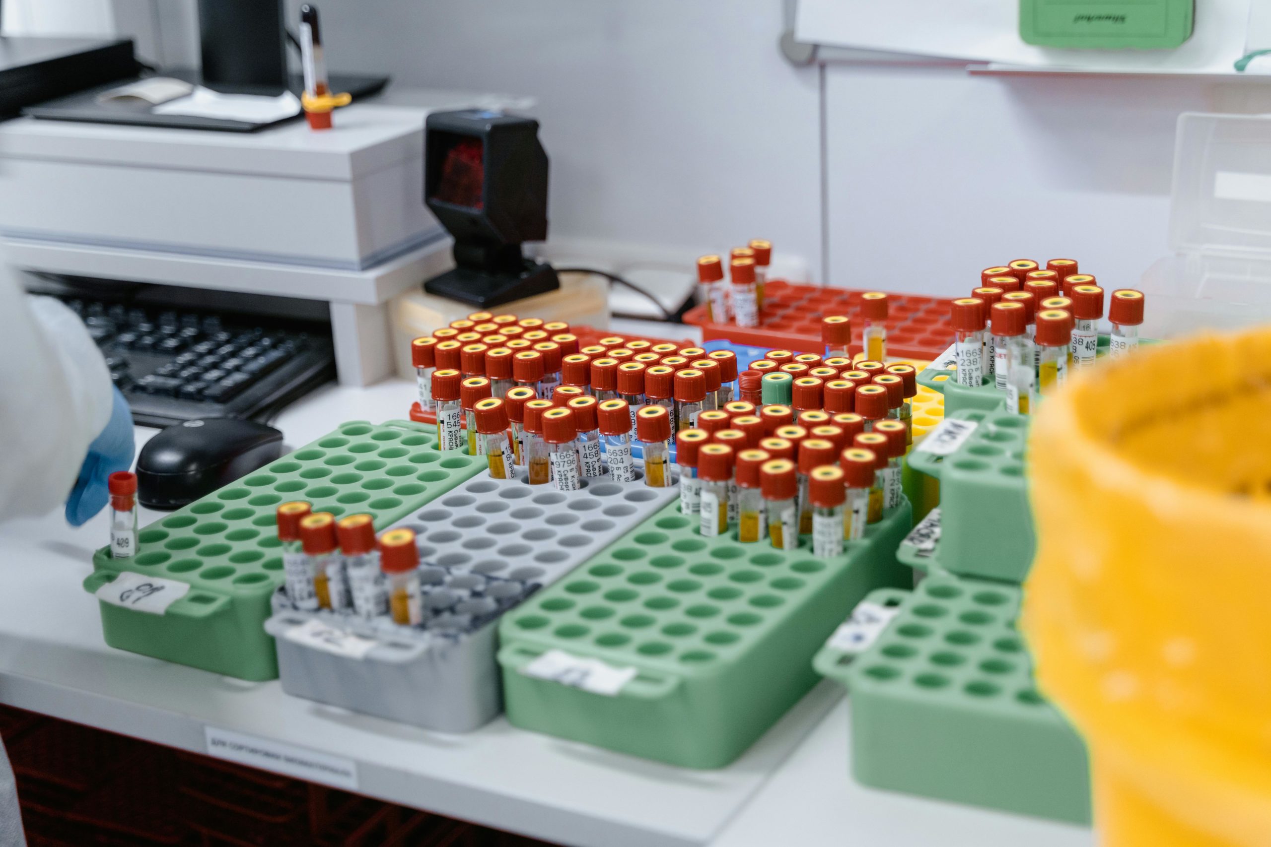 Gene Therapy and ophthalmic drug delivery